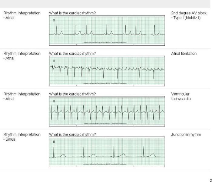 Relias dysrhythmia advanced test answers